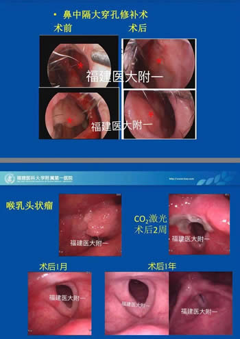 我院耳鼻咽喉科入選中國(guó)醫(yī)師協(xié)會(huì)（鼻科+咽喉科）內(nèi)鏡培訓(xùn)基地