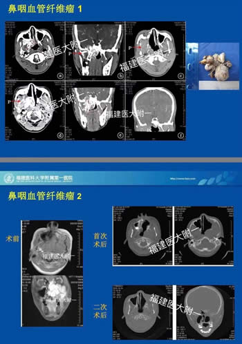 我院耳鼻咽喉科入選中國(guó)醫(yī)師協(xié)會(huì)（鼻科+咽喉科）內(nèi)鏡培訓(xùn)基地