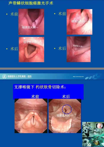 我院耳鼻咽喉科入選中國(guó)醫(yī)師協(xié)會(huì)（鼻科+咽喉科）內(nèi)鏡培訓(xùn)基地