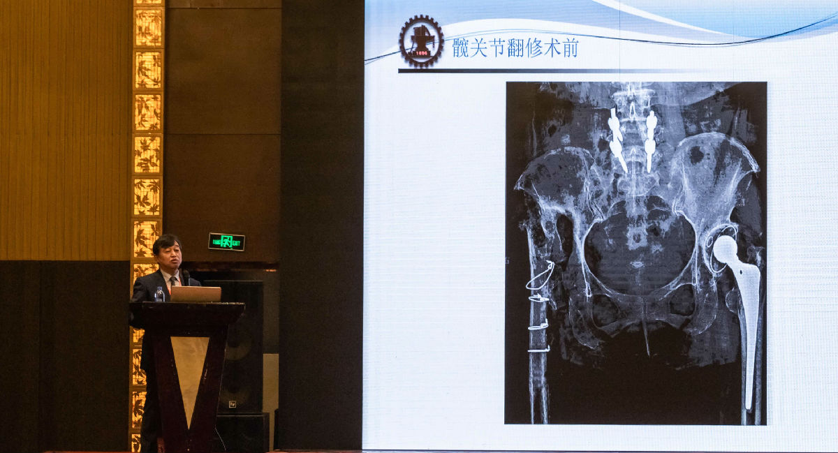 我院舉辦2019年福建省關(guān)節(jié)外科新進展學習班 ——特聘教授王坤正來訪并做學術(shù)交流