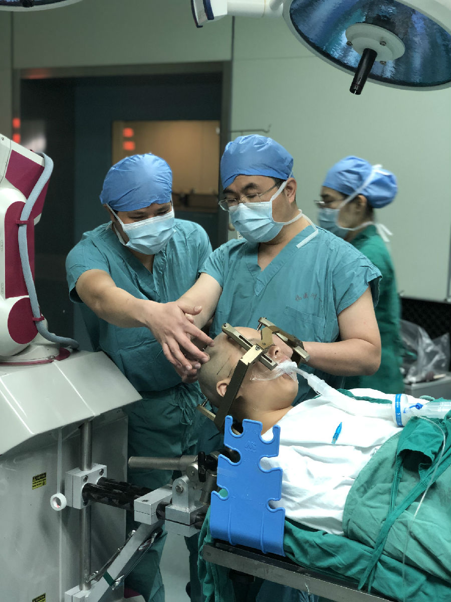 全國首例！我院利用國際新技術(shù)ROSA機(jī)器人 植入丘腦前核腦起搏器電極治療癲癇