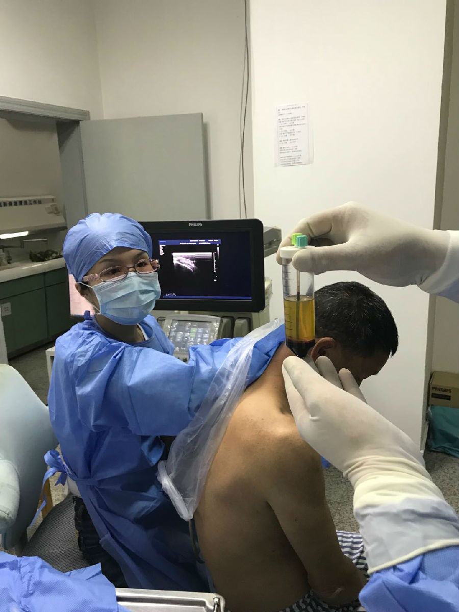 人體自帶的神奇修復血漿PRP ——緩解關節疼痛，修復肌腱損傷，加速創面愈合