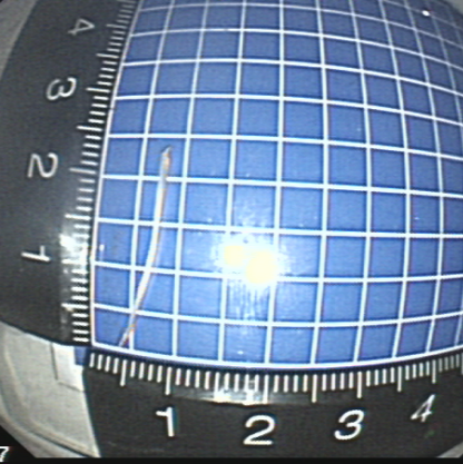 一根“流浪”的魚(yú)刺，一場(chǎng)多學(xué)科協(xié)作的搜尋 ——我院采用隧道內(nèi)鏡技術(shù)完成食管黏膜下異物探查