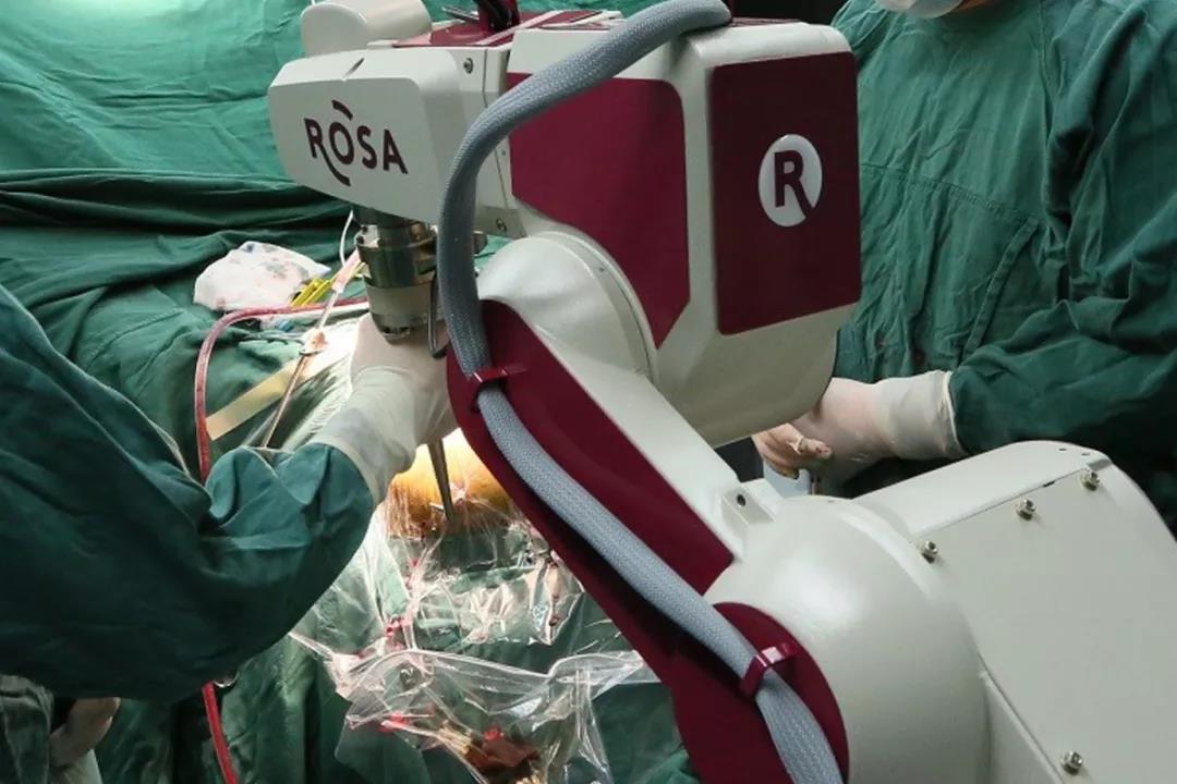 『媒體看附一』帕金森手術進入機器人時代