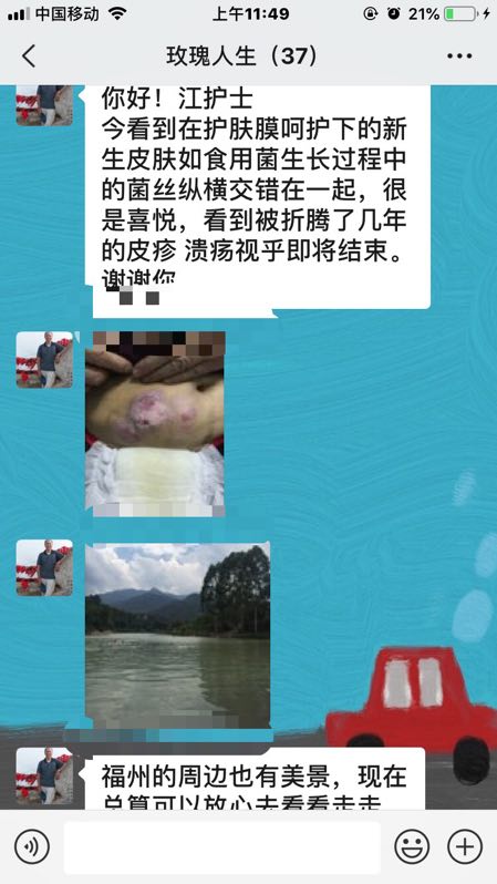 追光逐夢(mèng)，不忘初心，我是一名ET —---我們的“玫瑰天使”江平