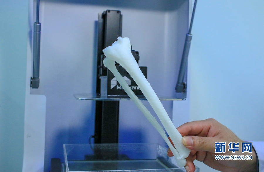 骨科臨床“黑科技”:3D打印技術讓手術更輕松 骨科臨床“黑科技”:3D打印技術讓手術更輕松