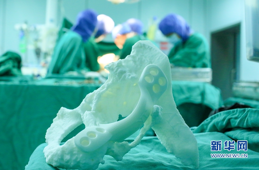 骨科臨床“黑科技”:3D打印技術讓手術更輕松 骨科臨床“黑科技”:3D打印技術讓手術更輕松