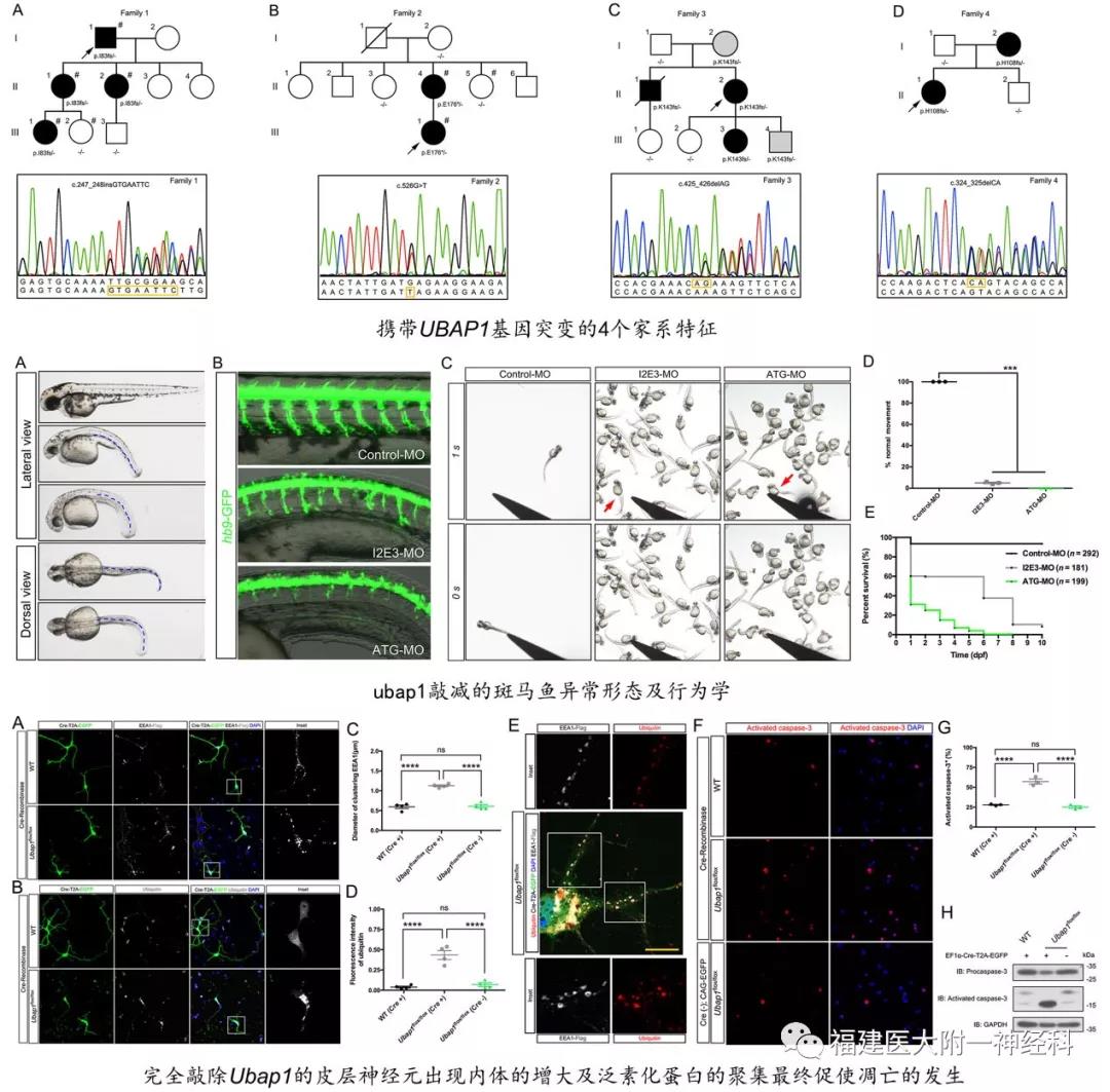 我院陳萬金教授和王檸教授團隊發(fā)現(xiàn) 遺傳性痙攣性截癱新亞型及新致病基因 我院陳萬金教授和王檸教授團隊發(fā)現(xiàn) 遺傳性痙攣性截癱新亞型及新致病基因