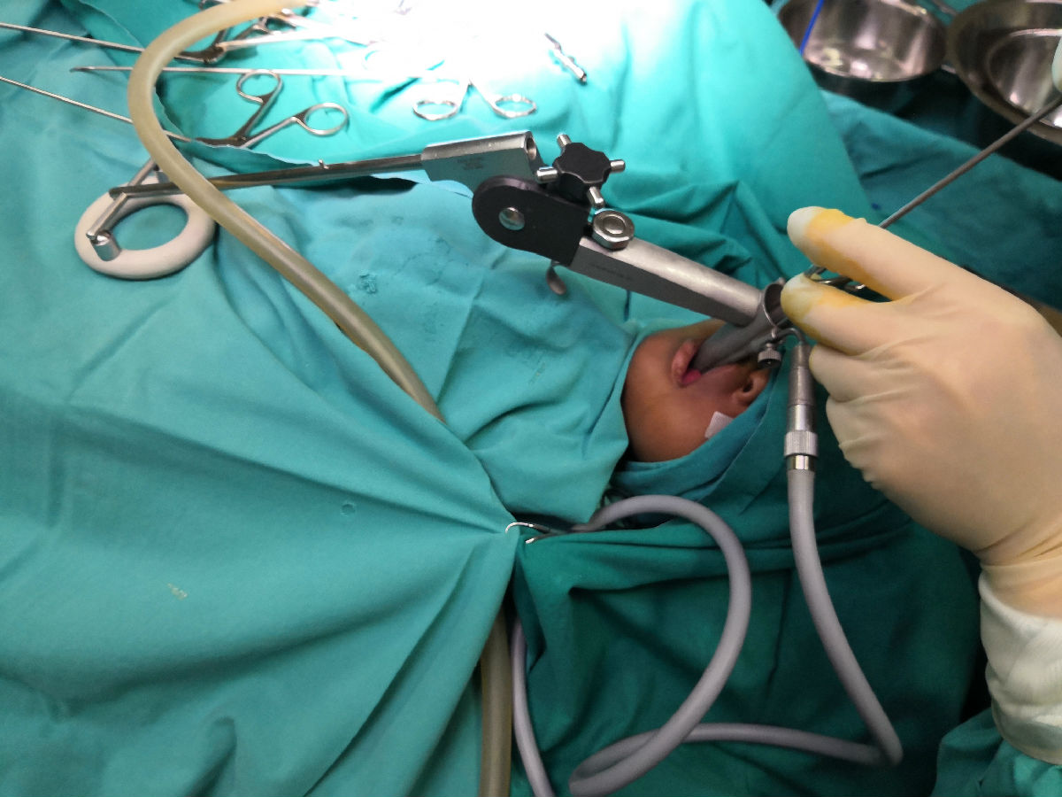 中央電視臺(tái)《華人世界》報(bào)道我院援博隊(duì)員陳希杭先進(jìn)事跡 ——自制手術(shù)器械幫助當(dāng)?shù)貗雰呵谐喔夷[