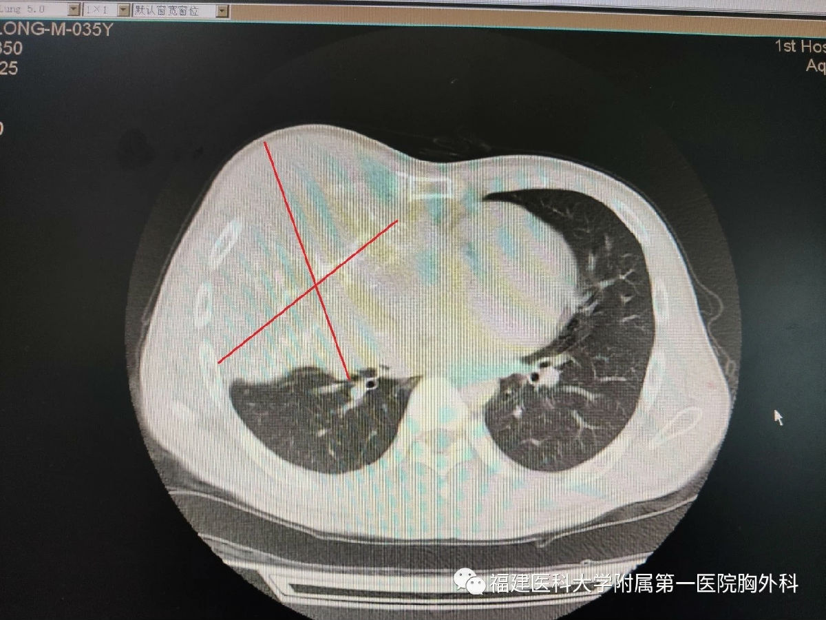 “拆彈”專家的“藝術品”