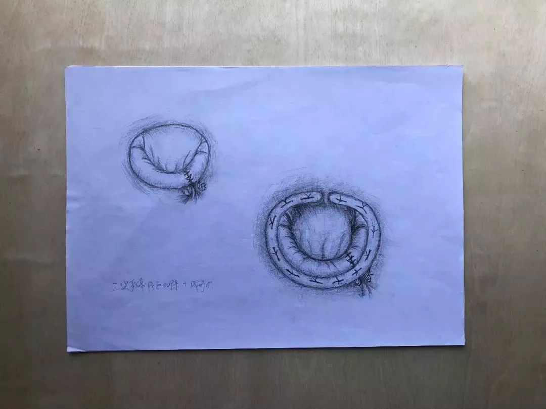 『媒體看附一』隱藏在附一醫院的“靈魂畫手”