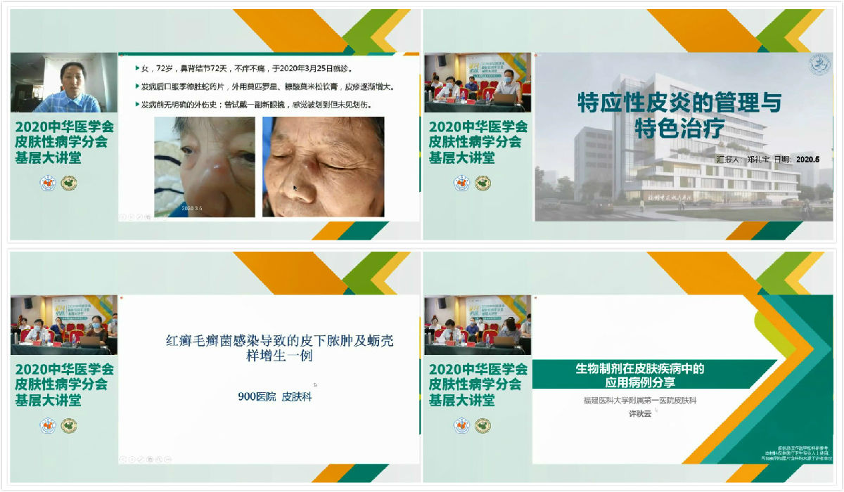 中華醫(yī)學(xué)會(huì)皮膚性病學(xué)分會(huì)基層大講堂福建站順利召開(kāi) 中華醫(yī)學(xué)會(huì)皮膚性病學(xué)分會(huì)基層大講堂福建站順利召開(kāi)