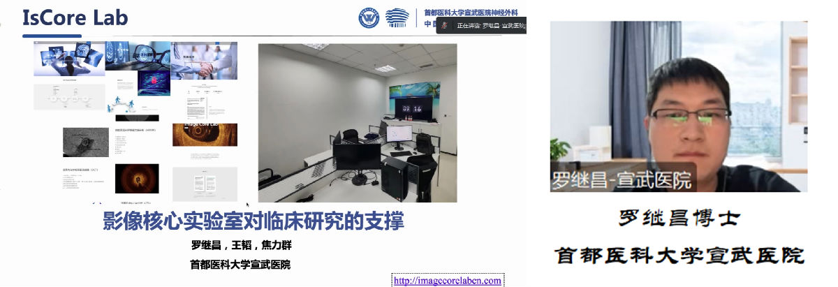 我院神經內科舉辦腦血管病學術交流會