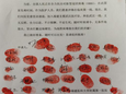 『附一抗疫』守護(hù)生命，抗擊疫情
——急診科戰(zhàn)“疫”事記